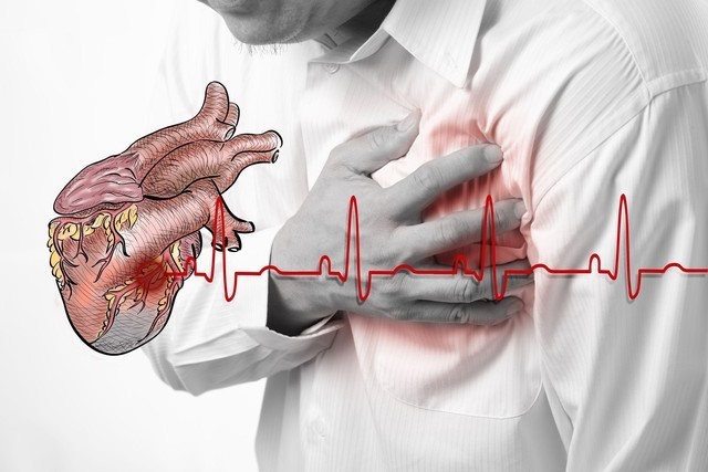 Bệnh tim mạch là gì? Nguyên nhân, triệu chứng và cách phòng ngừa.